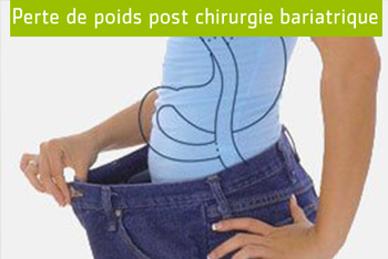 Perte de poids post Chirurgie bariatrique